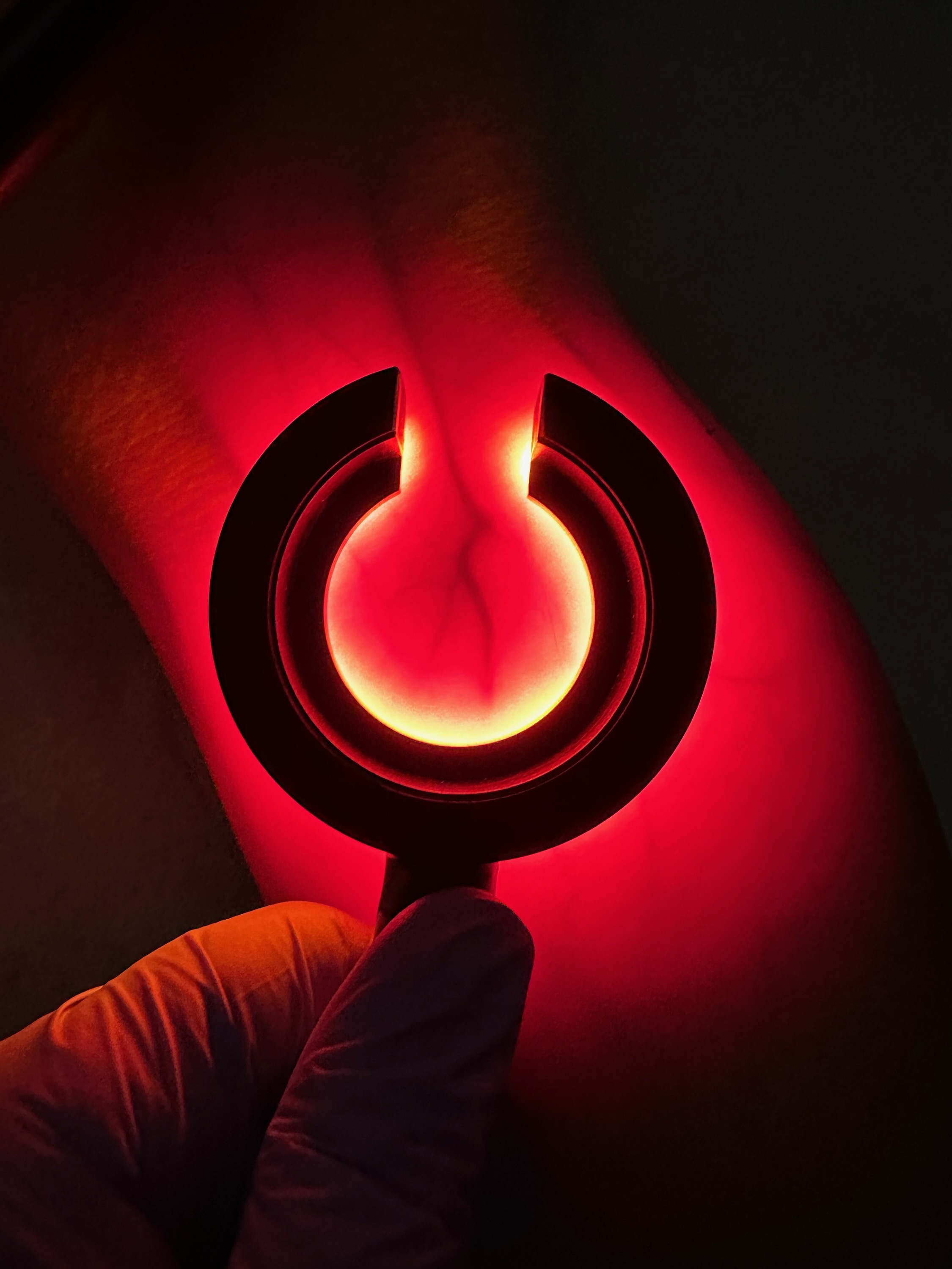 A image of a vein illuminated by red light